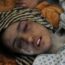 Afghanistan, la sposa bambina torturata ottiene giustizia. Cannabis contro la depressione. Onu: risoluzione per assicurare i diritti sessuali ai giovani. La 'fame edonistica' che porta ad abbuffarsi. SCENARIO CRISI: 25% donne interrompe cure per costo medicine. Suicidi: pericolo effetto domino. 